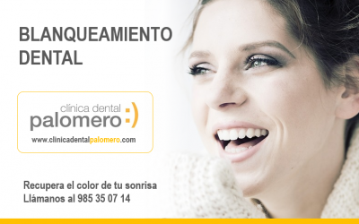 Blanqueamientos dentales