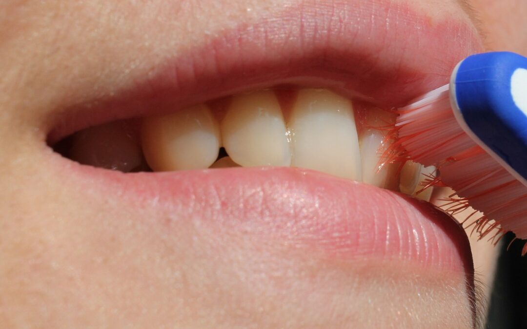 9 cuidados para implantes dentales