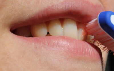 9 cuidados para implantes dentales