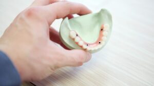 Dentadura fija sobre 4 implantes