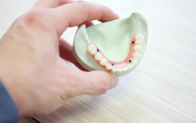 Dentadura fija sobre cuatro implantes