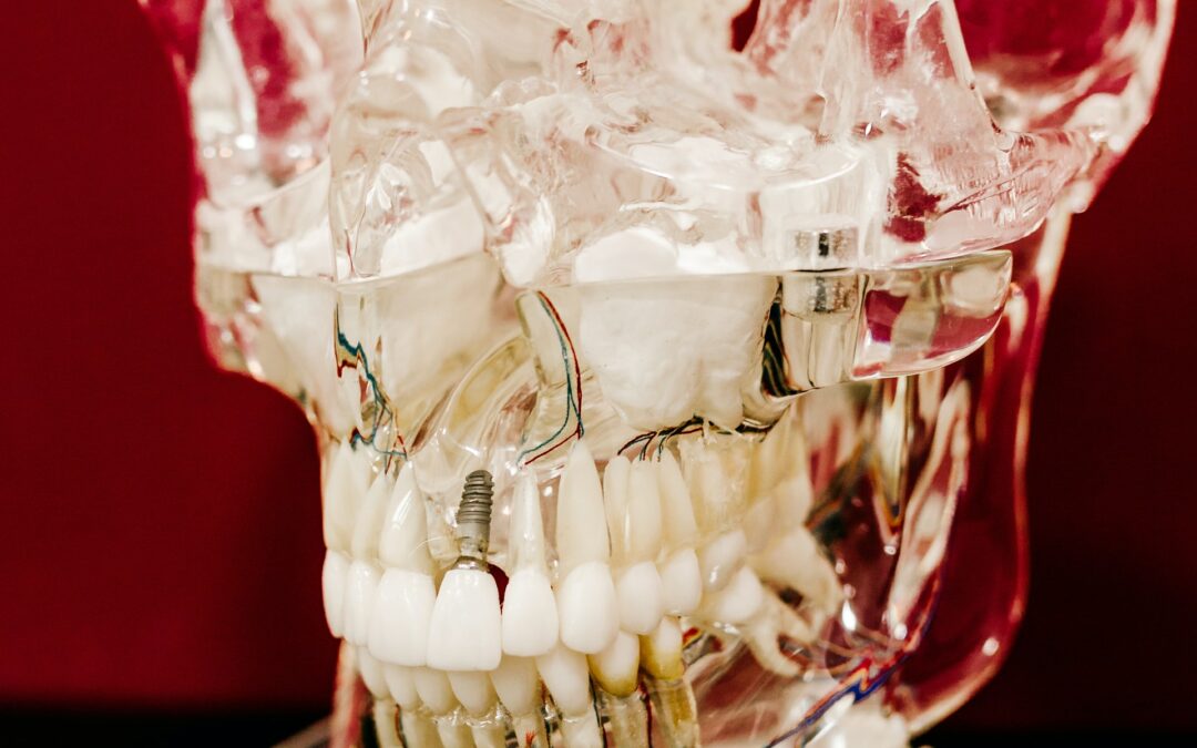 Implantes dentales en un día o de carga inmediata