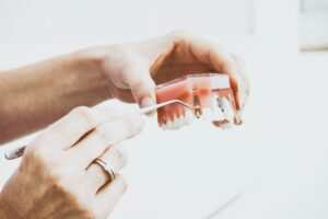 Implantes dentales en un día o de carga inmediata