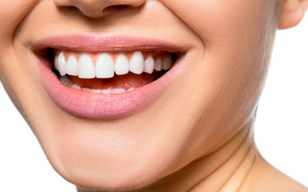 coronas-dentales-de-porcelana-en-que-casos-se-colocan-y-cuales-son-sus-principales-caracteristicas