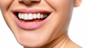 coronas-dentales-de-porcelana-en-que-casos-se-colocan-y-cuales-son-sus-principales-caracteristicas