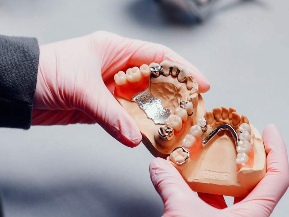 Cómo limpiar mi prótesis dental removible