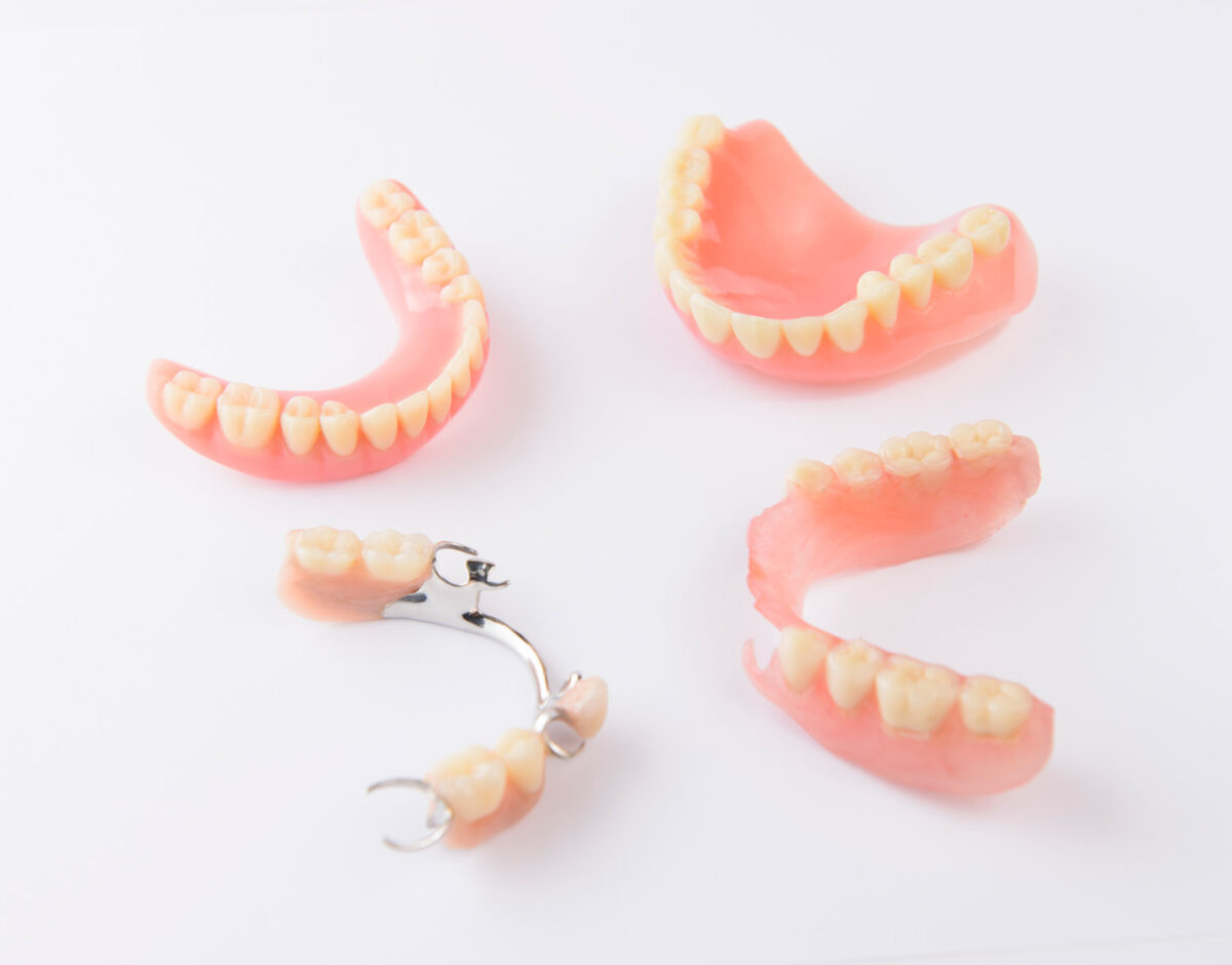 Mitones Desarmado promoción Tipos de prótesis dentales. Fijas y removibles