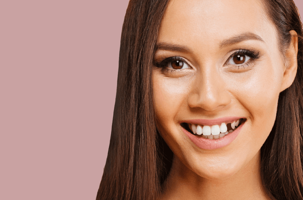 Soluciones para falta de piezas dentales