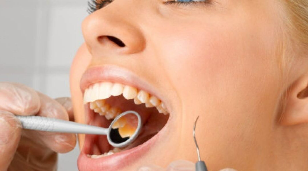 ¿En qué consiste una limpieza dental profunda y cuándo hay que hacerla?