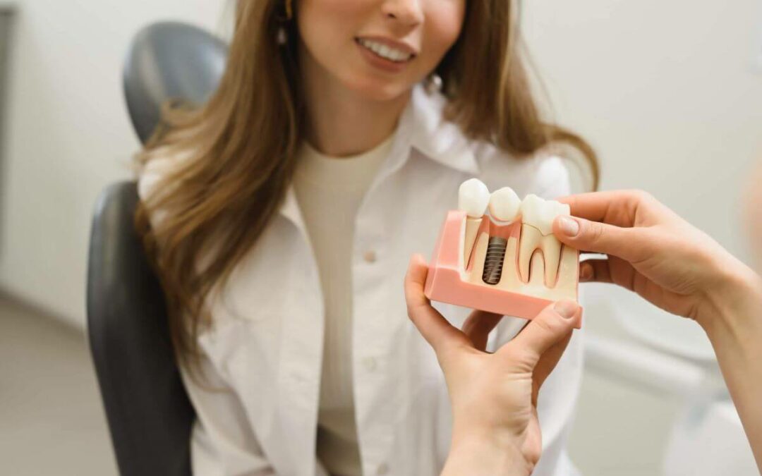 Implantes Dentales: Prótesis atornillada vs cementada