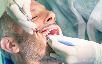 Cirugía dental en Gijón