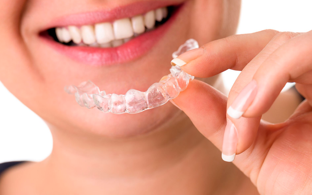 limpiar invisalign