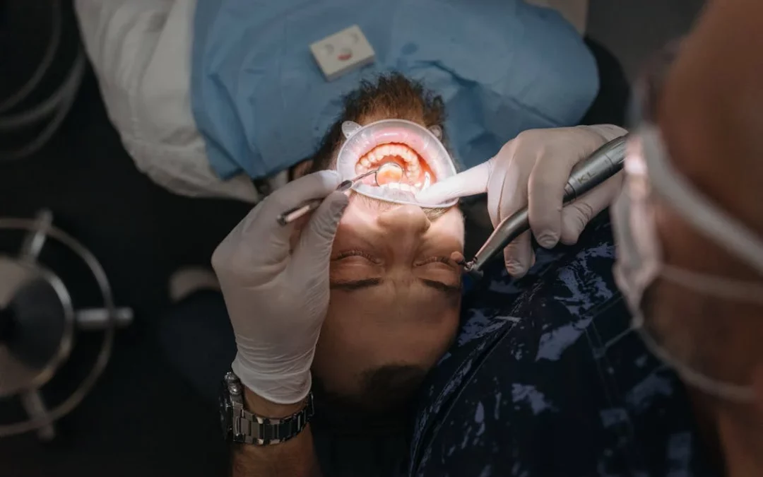 raspado dental