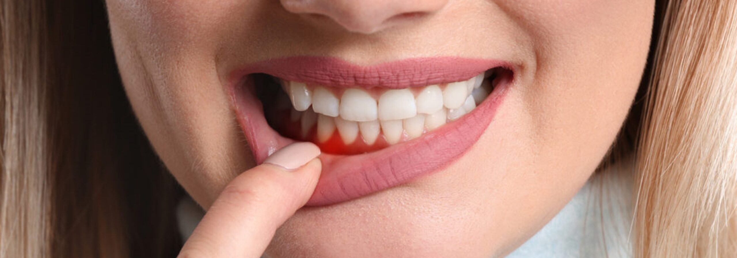 periodoncia 1