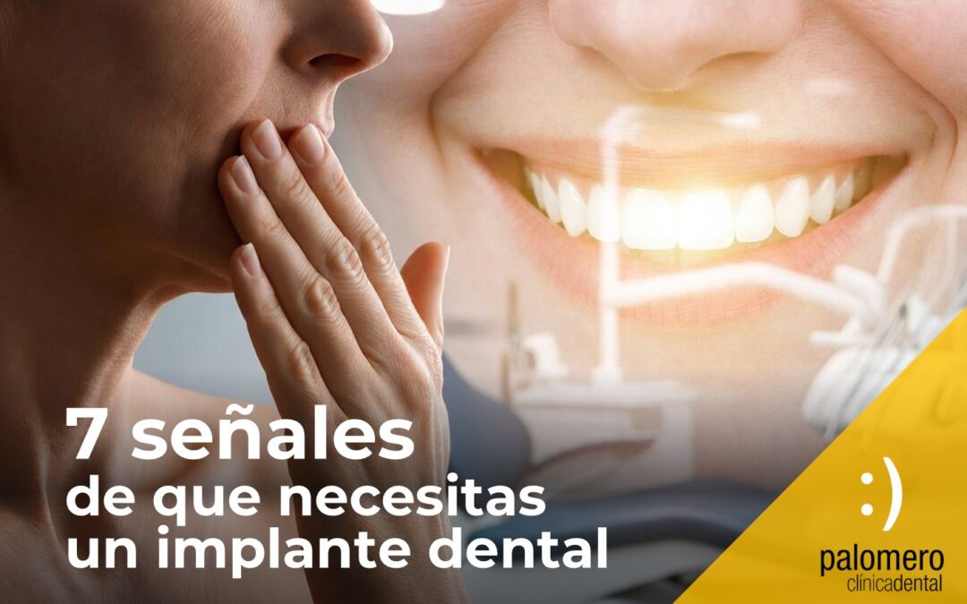7 señales de que necesitas un implante dental