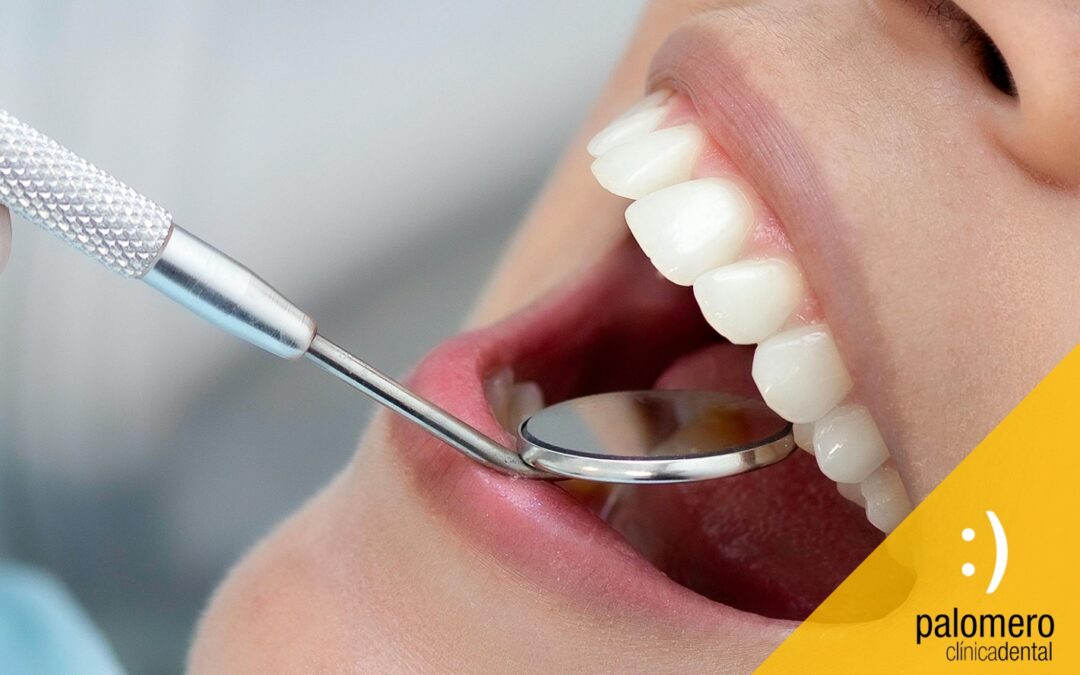 ¿Qué es una limpieza dental profesional profunda?